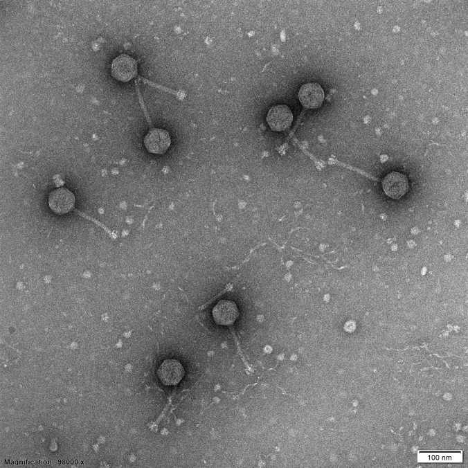 transmission electron microscopy of phage PS11 – a so-called siphovirus – isolated by a high schooler together with us
