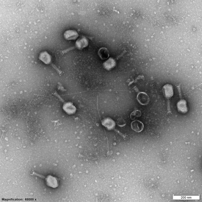 transmission electron microscopy of phage NA32 – a so-called myovirus – isolated by a high schooler together with us